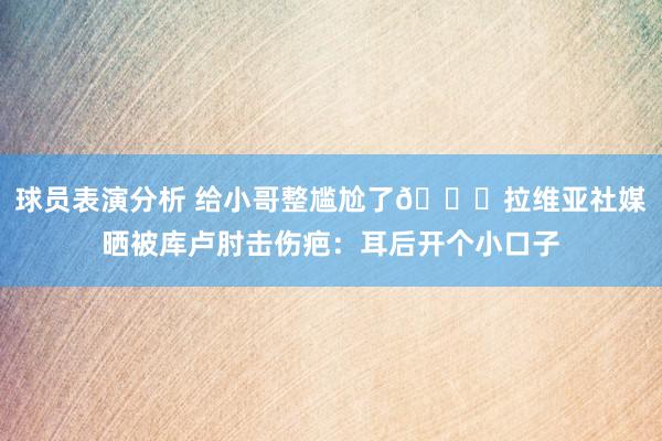 球员表演分析 给小哥整尴尬了😅拉维亚社媒晒被库卢肘击伤疤：耳后开个小口子